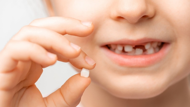 Răng sữa đẹp thì răng vĩnh viễn xấu, đúng hay sai? 3