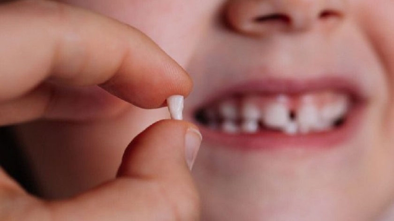 Răng sữa trẻ em có thay hết không? 1