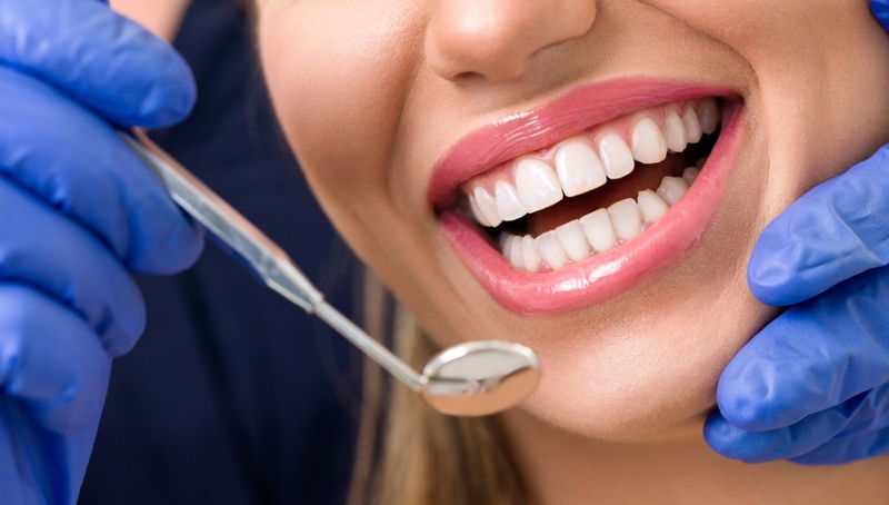 Răng toàn sứ Venus Multi và những điều không phải ai cũng biết 4