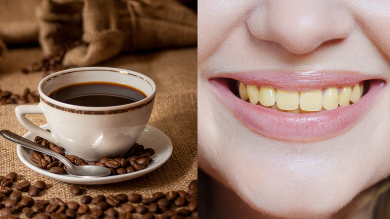 Răng vàng là bệnh gì? Tìm hiểu nguyên nhân và cách khắc phục vàng răng 1