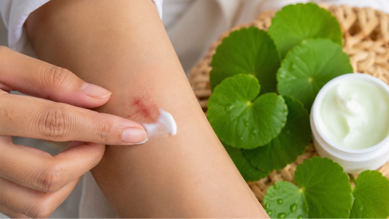 Chiết xuất rau má hỗ trợ quá trình làm lành vết thương