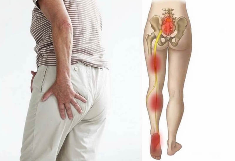 Rau muống biển dùng để chữa đau thần kinh toạ