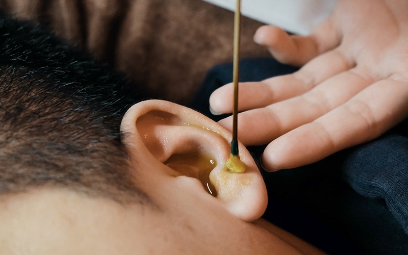 Ráy tai khô và ráy tai ướt có gì khác nhau? 1