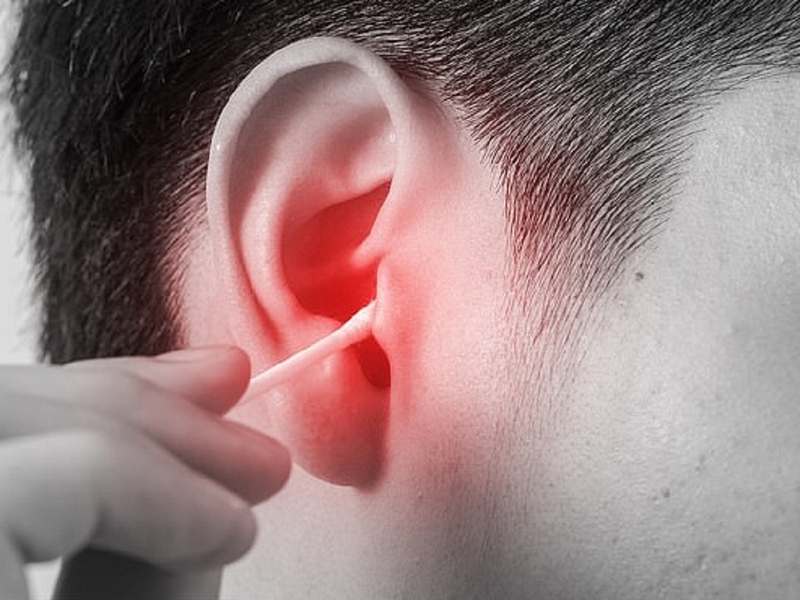 Ráy tai là gì, màu sắc ráy tai biểu thị bệnh lý gì? 3