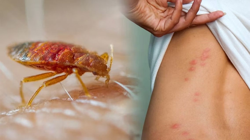 Rệp giường hoạt động mạnh vào ban đêm và gây ngứa kéo dài