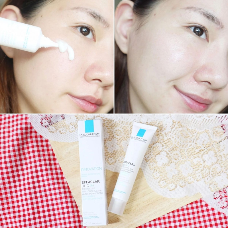 Review: Kem trị mụn La Roche Posay Duo+ có tốt không 2