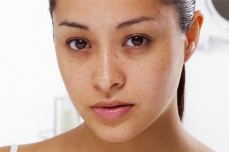 Mất nước là một trong những nguyên nhân gây thâm quầng mắt