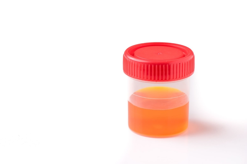 Rối loạn chuyển hóa bẩm sinh là gì? Vai trò của dinh dưỡng trong điều trị bệnh 4