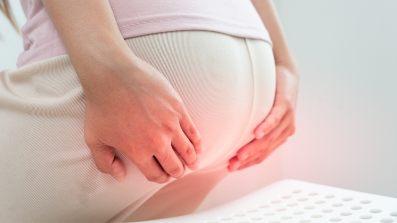 Trĩ độ III - IV có thể sa ra ngoài hoàn toàn và không tự co vào được, gây cảm giác vướng víu, đau rát khi ngồi hoặc đi lại