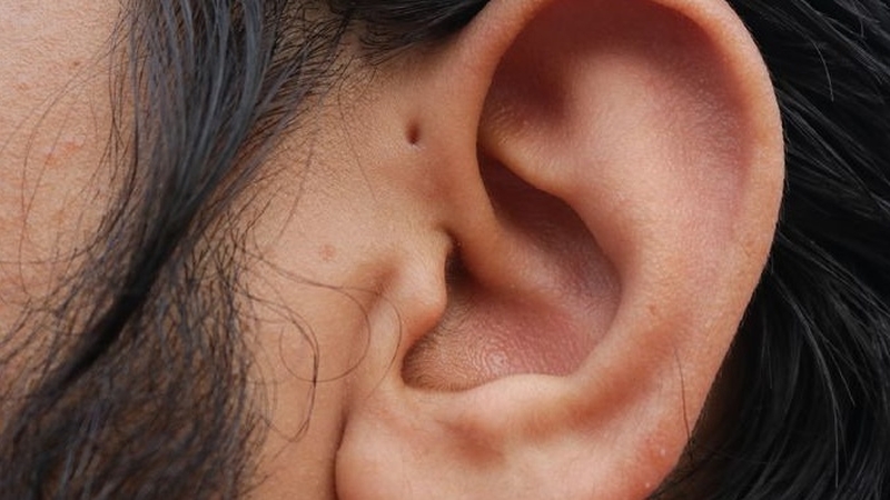 Rò luân nhĩ ở người lớn nguy hiểm không? Cách chữa như thế nào? 1