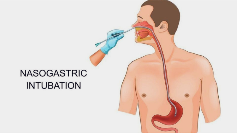 ro-thuc-quan-va-khi-quan-nguyen-nhan-trieu-chung-va-phuong-phap-dieu-tri 3.png