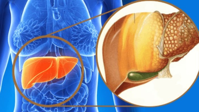 Rối loạn chuyển hóa là gì? Hiểu đúng để điều trị và phòng tránh hiệu quả 3