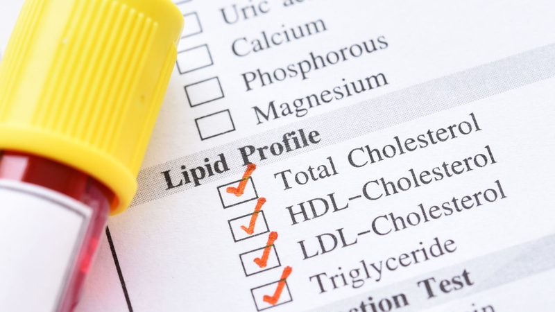 Rối loạn chuyển hóa lipid​: Nguyên nhân, triệu chứng và phương pháp chẩn đoán 6