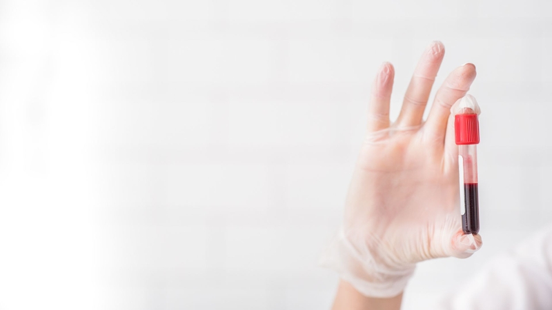 Rối loạn chuyển hóa lipid gây bệnh gì? Phương pháp chẩn đoán và điều trị 3