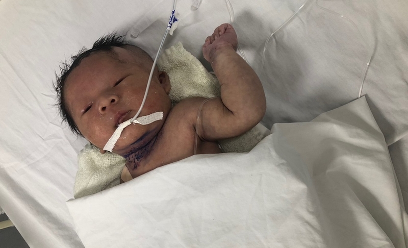 Rối loạn chuyển hóa ở trẻ sơ sinh do nguyên nhân gì? Lưu ý để phát hiện sớm 4