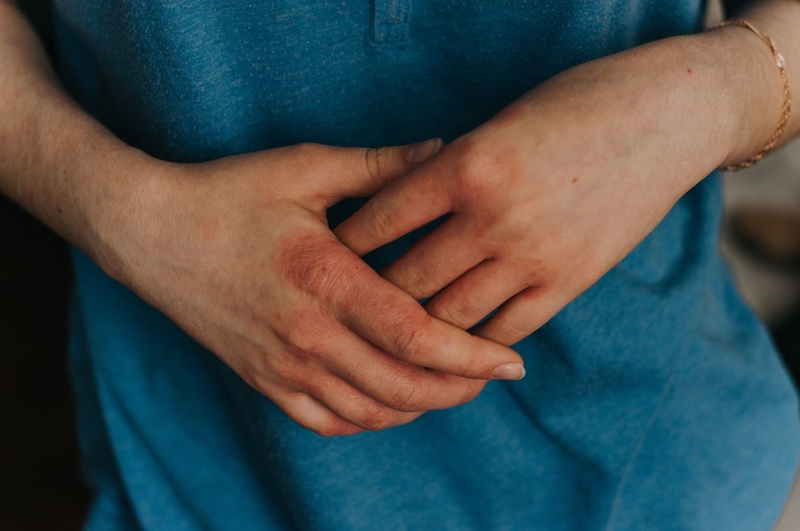 Rối loạn chuyển hóa Porphyria và những thông tin cần biết