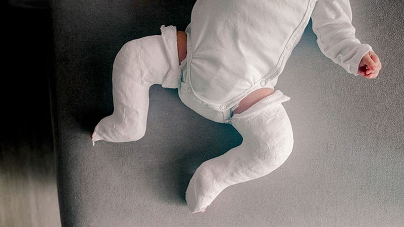 Rối loạn cơ xương: Nguyên nhân, cách điều trị và phòng ngừa 3