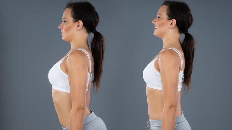 Rối loạn cong cột sống là gì? Có chữa được không? 1