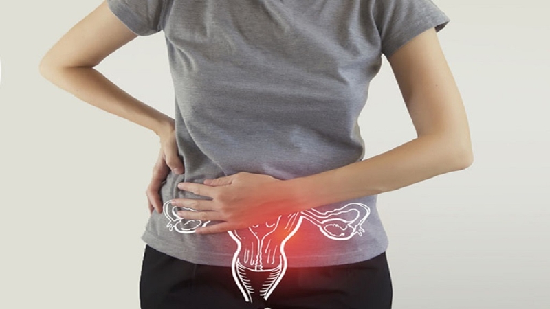 Rối loạn kinh nguyệt tiền mãn kinh có thể là triệu chứng của một số bệnh lý phụ khoa