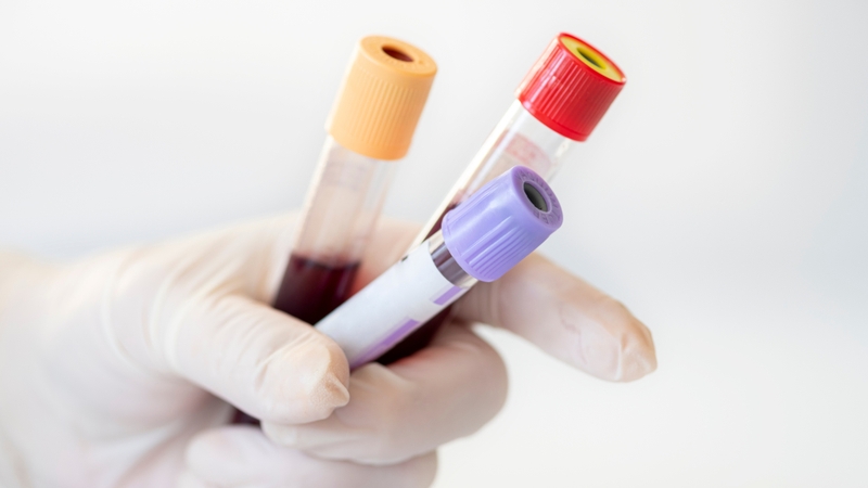 Rối loạn PANDAS là gì? Những điều bạn cần biết về rối loạn PANDAS 4