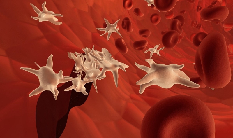 Rối loạn tế bào máu là gì? Triệu chứng và phân loại rối loạn tế bào máu 4