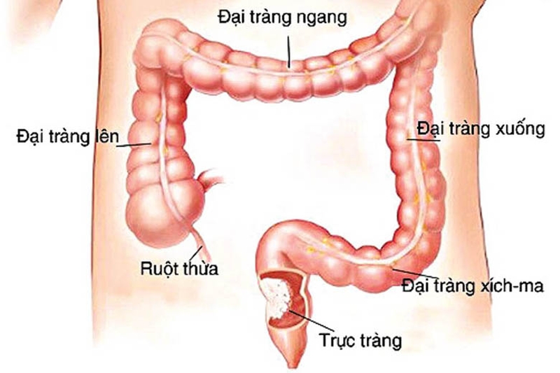 rối loạn tiêu hóa ở người tiểu đường 3