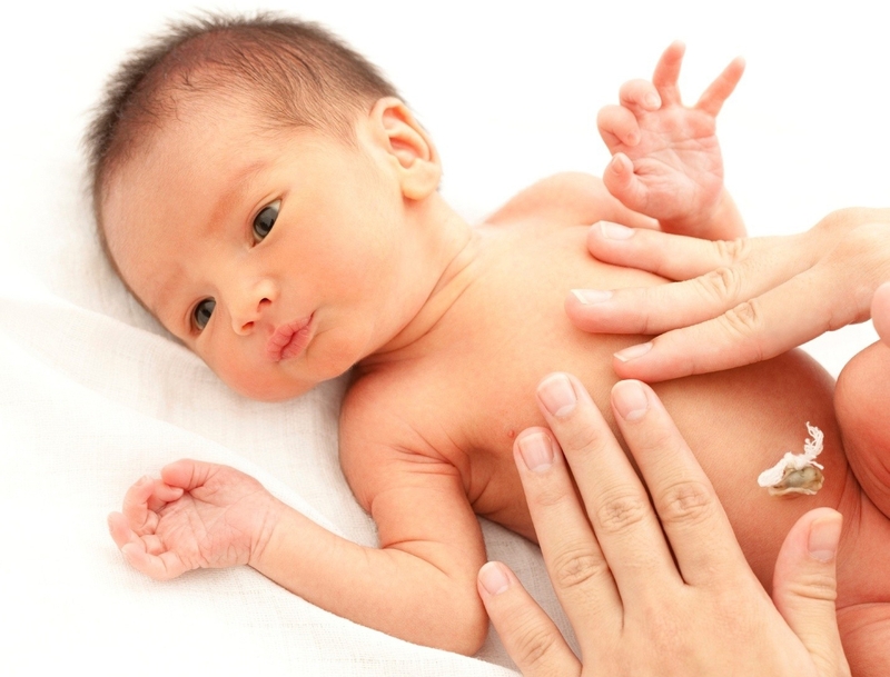 Rốn lồi bất thường ở trẻ do nguyên nhân gì? Có thể tự khỏi không? 1