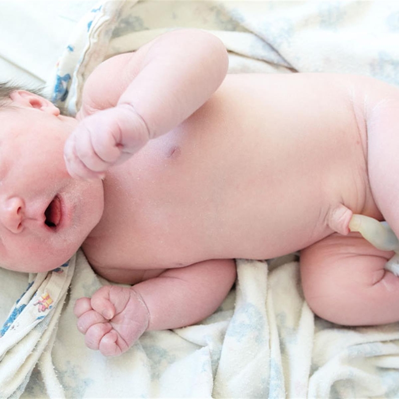 Rốn trẻ sơ sinh bao lâu thì thụt vô được?1