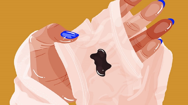 Cục máu đông xuất hiện trong kỳ hành kinh có thể là do rối loạn trong quá trình đông máu của cơ thể