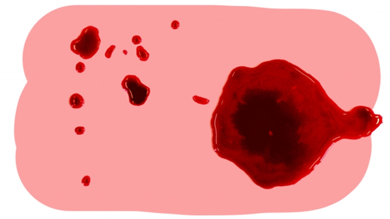 Ở giai đoạn dậy thì, chu kỳ kinh nguyệt chưa thực sự hoàn chỉnh và rong kinh ở trẻ dậy thì là một dạng rối loạn rất thường gặp