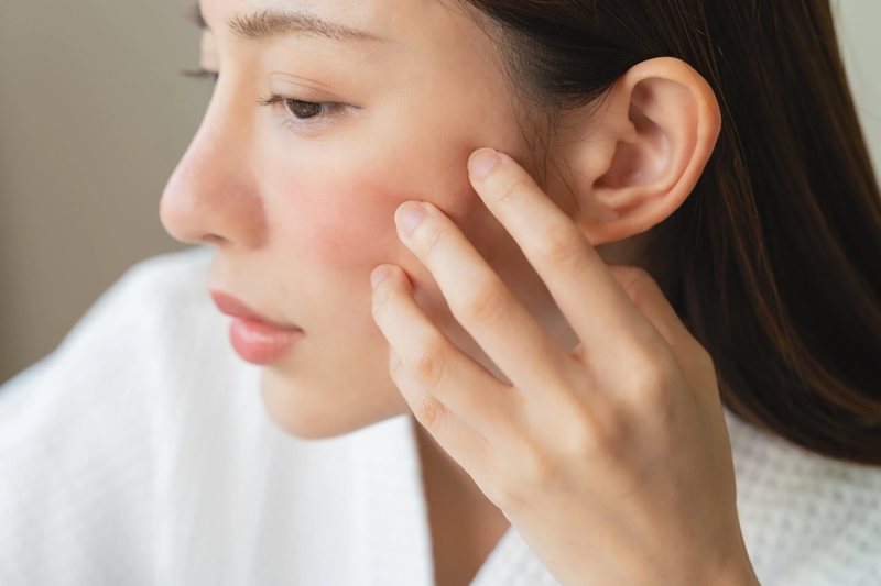 Dùng nước quá lạnh để rửa mặt khiến da kích ứng, nổi mẩn