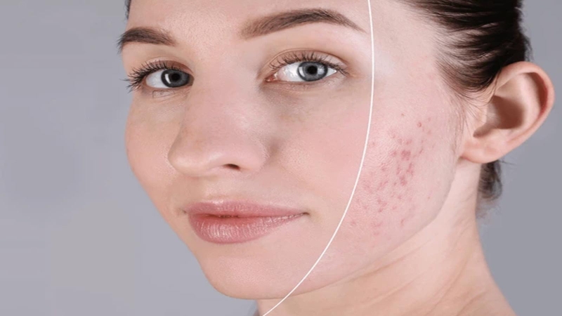 Hướng dẫn rửa mặt đúng cách với nước vo gạo 1