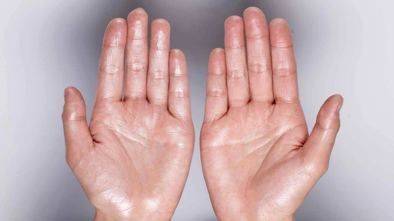 Run do rối loạn thần kinh thực vật là gì? 3