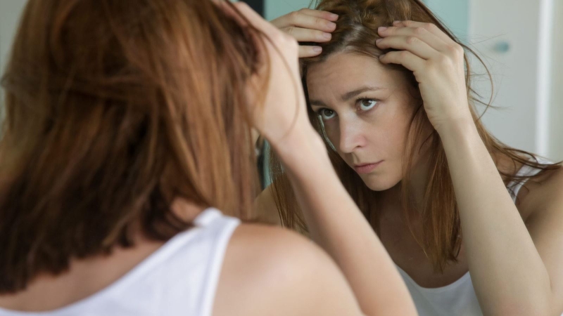 Rụng tóc Telogen là gì? Cách khắc phục tình trạng này