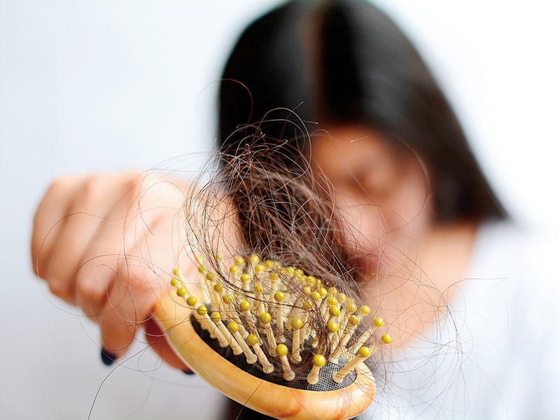 Rụng tóc thiếu chất gì? - Mách bạn phương pháp ngăn ngừa hiệu quả 1