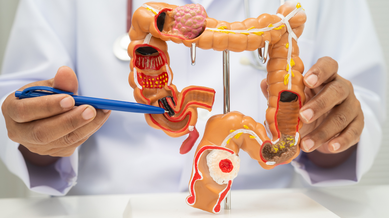 Ở người trưởng thành, ruột già có chiều dài trung bình từ 1,2 đến 1,5 mét