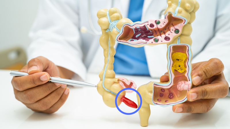 Nhiều người vẫn thắc mắc “ruột thừa là gì?”