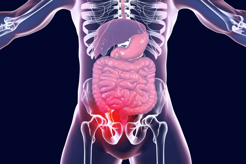 Ruột thừa nằm bên nào? Dấu hiệu nhận biết đau ruột thừa 2