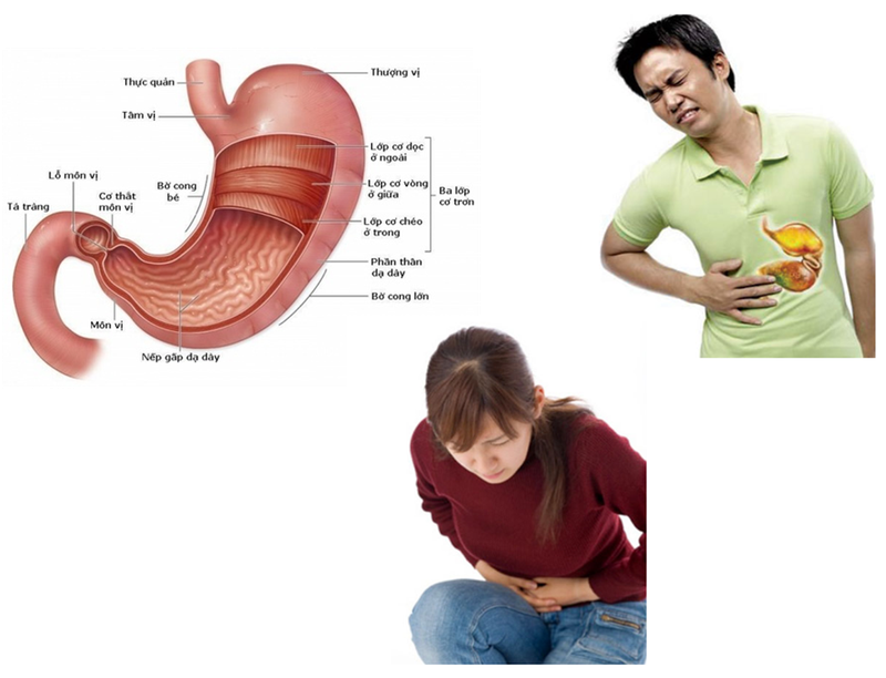 Rượu bia làm nhiều người khốn khổ vì viêm loét dạ dày 1