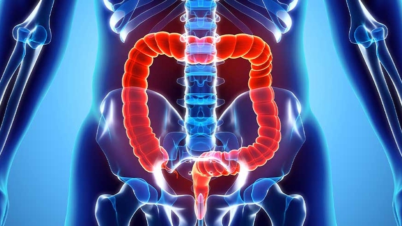 Sa trực tràng và trĩ có giống nhau không? Cách phân biệt 3