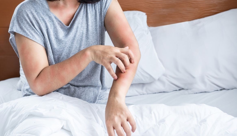 Điều trị sán chó uống thuốc gì? Lưu ý khi uống thuốc trị sán chó 3