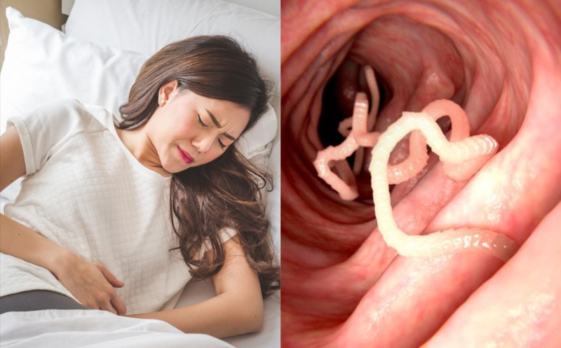 Nhiễm sán dây cá: nguyên nhân, triệu chứng và cách phòng ngừa 1