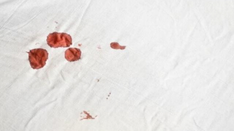 Sản dịch ra màu nâu