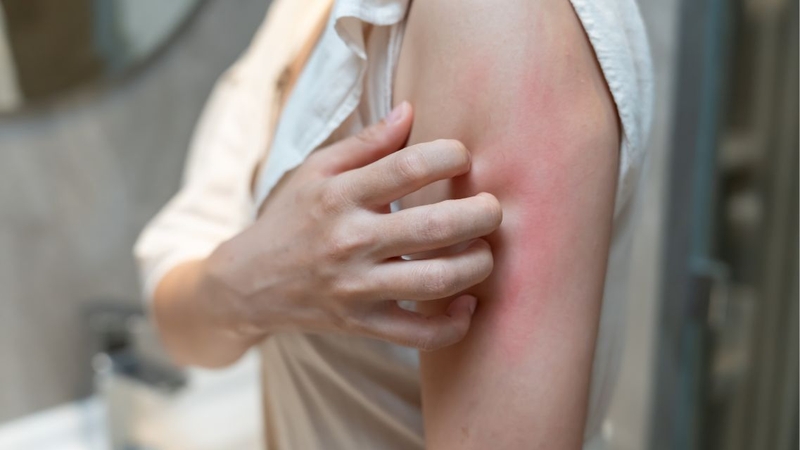 Đau bụng, tiêu chảy, ngứa da có thể xuất hiện khi nhiễm sán lá ruột lớn