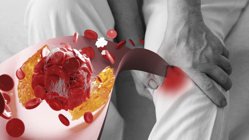 san-pham-thoai-hoa-fibrin-fdp-la-gi 2