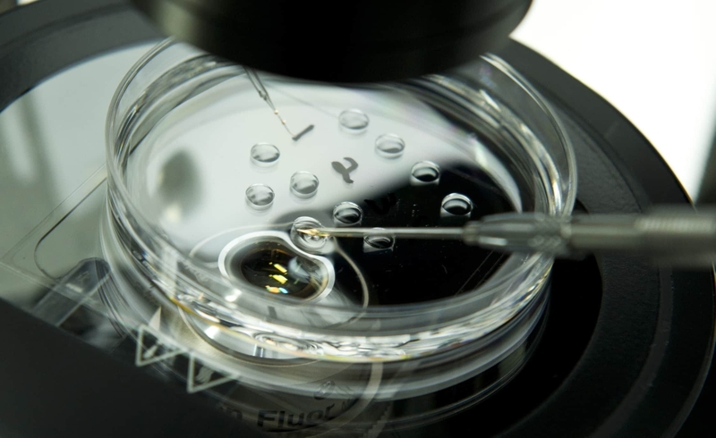 sang-loc-phoi-roi-co-can-lam-nipt-khong 1.jpg