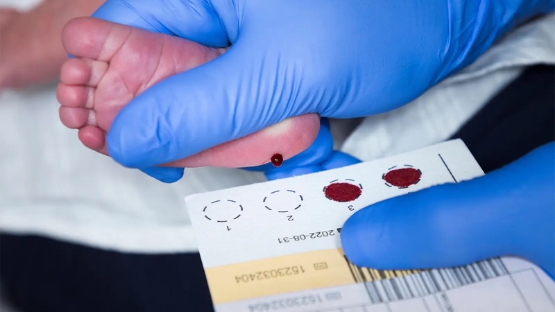 “Sàng lọc rối loạn chuyển hóa bẩm sinh bằng MSMS là gì?” chắc hẳn là câu hỏi mà nhiều ba mẹ thắc mắc hiện nay