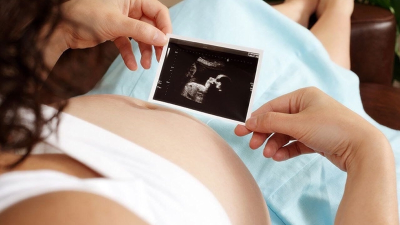 Sàng lọc trước sinh: Nên chọc ối hay làm xét nghiệm NIPT 3