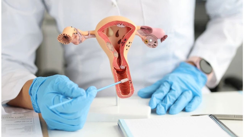 Sàng lọc Ung thư cổ tử cung: Tại sao xét nghiệm HPV lại quan trọng? 3