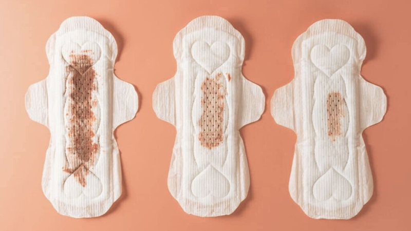 Sau chuyển phôi ra dịch nâu cũng có thể là dấu hiệu cảnh báo bất thường